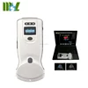 /product-detail/mini-ultrasound-scan-machine-medical-ultrasound-scanner-probe-wireless-ultrasound-60733091385.html