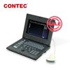 /product-detail/laptop-ultrasound-scanner-diagnostic-system-cms600p-portable-ultrasound-convex-probe-notebook-style-medical-ultrasound-60113577864.html