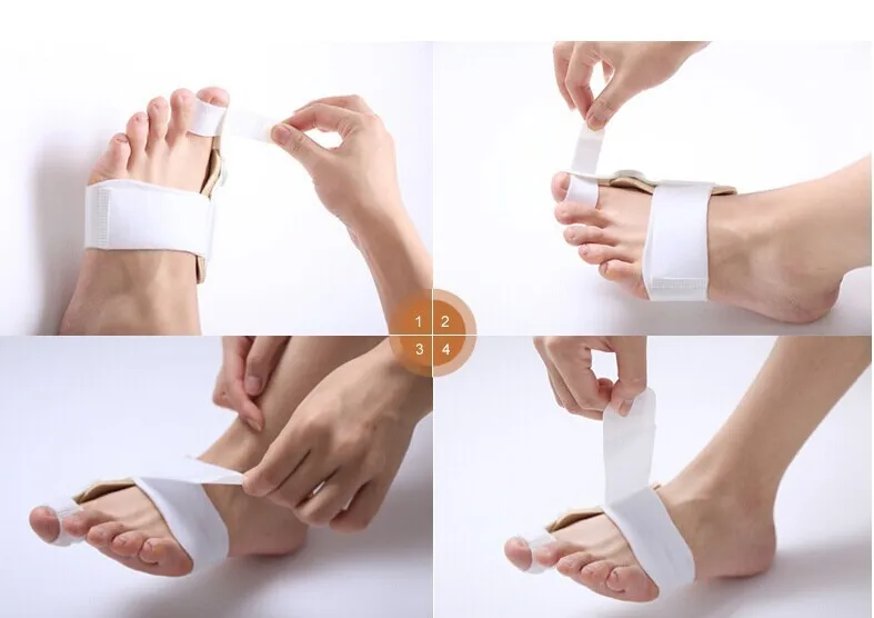 toe splint (1)