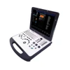 /product-detail/lta-c60-hot-sale-mini-portable-ultrasound-scan-machine-60805803863.html