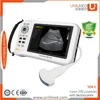 /product-detail/chinese-handheld-mini-portable-ultrasound-machines-for-cavitation-scanner-60581021321.html