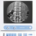 Medical Xray X Ray Direct Xray Orthopedics Medical Xray Machine C Arm X Ray Machine Price PLX116B