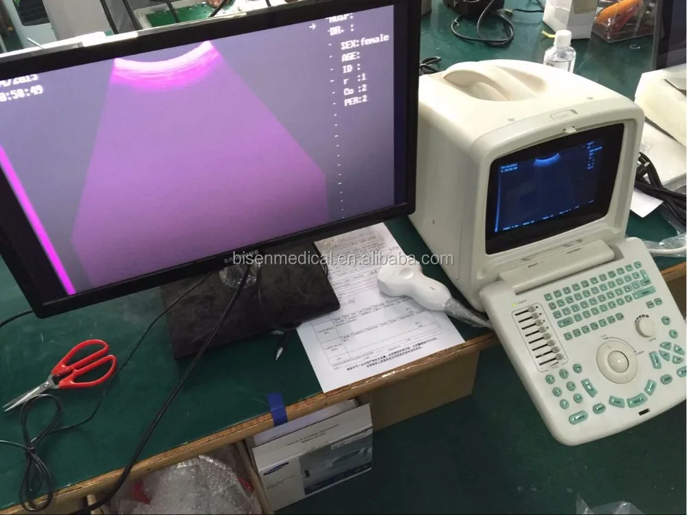 Cheap powerful function ultrasound scanner with convex array probe pretty and portable appearance