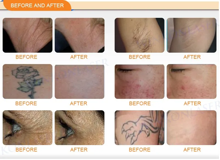 Safe & effective slimming machine multifunction facial beauty machine cavitation vacuum rf lipo laser