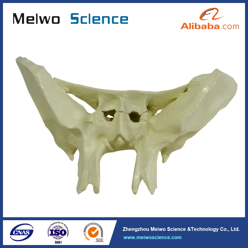 sphenoid bone