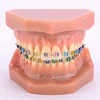 Dental Orthodontic model With metal bracket