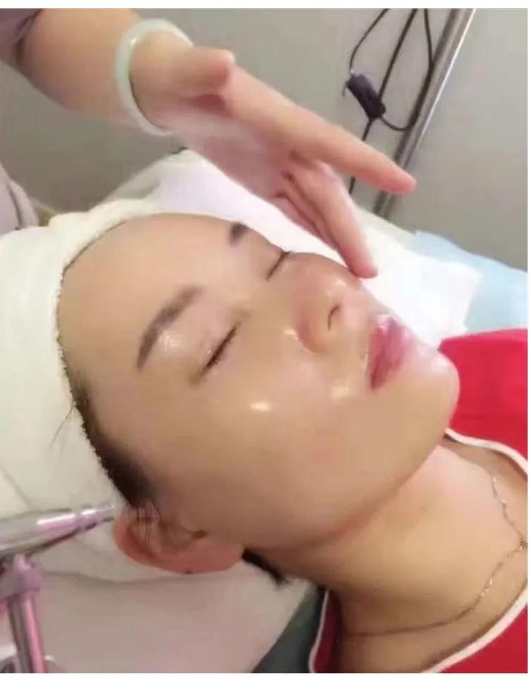 oxygen facial clean jet peel skin rejuvenation machine