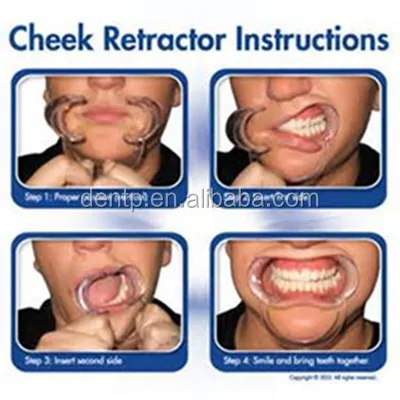 Cheek retractor 4.jpg