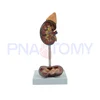 PNT-0561 life size kidney model