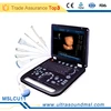 Christmas Promotion Cheapest 3D portable Color doppler ultrasound machine with muliti languages MSLCU11E