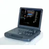 cheap 3d ultrasound medical diagnostic equipment & low price 3d ultrasound machine