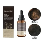 Wholesale Private label natural organic Hair growth oil Hair Regrowth serum Hair care essential oil