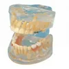 BIX-L1009 Transparent deciduous teeth development model with marks