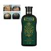 Anti hair Loss shampoo with new formula special for hair loss