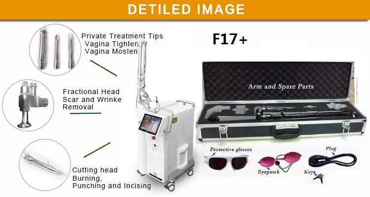 best skin tag removal laser 4d fotona laser system