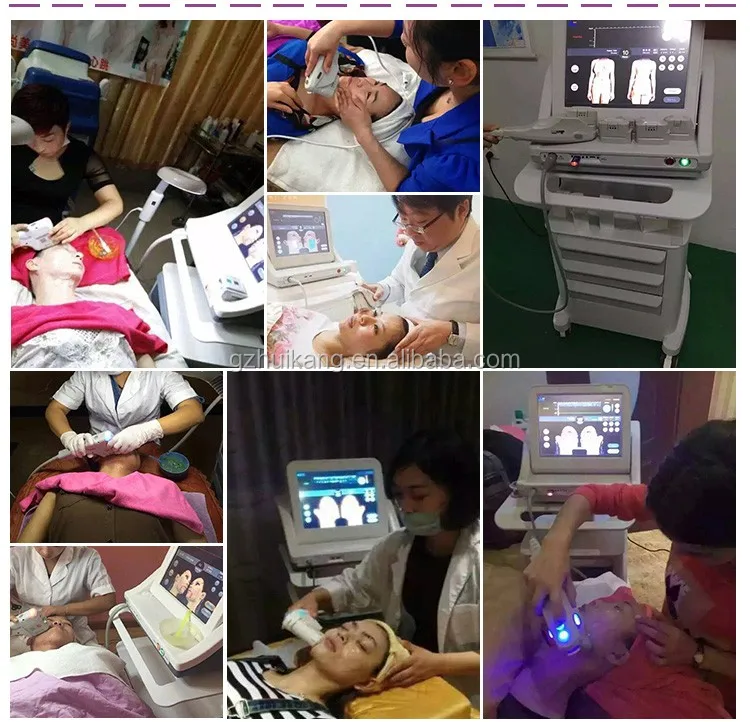 high frequency facial machine OPT SHR IPL RF Nd YAG Laser beauty equipment