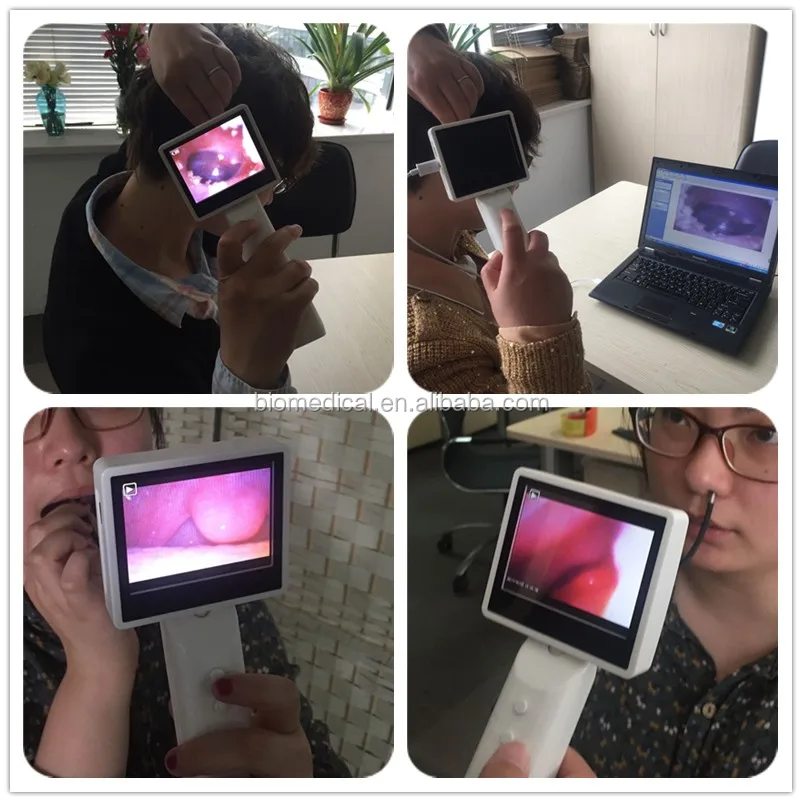 video laryngoscope.jpg