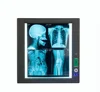 Factory medical x-ray film Ultra slim LED medical film viewer MSLGP01/medical image film
