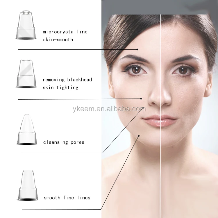 Blackhead remover vacuum.jpg