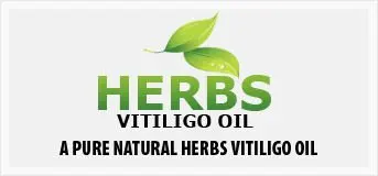 Herbs Vitiligo oil