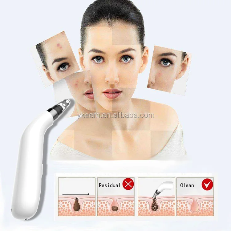 blackhead remover.jpg