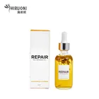 100% Pure Plant Extract Skin Care Treatment Acne Scar Repairing Face Serum Oil with Jojoba