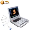 cheap portable color doppler ultrasound ce approved veterinary use full digital ultrasound scanner