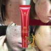 MEIYANQIONG Skin Care Natural Herbal Acne Treatment Oil Control Smoothing Acne Clearing Gel