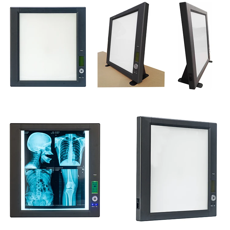 High brightness ultra slim medical LED x-ray film viewer