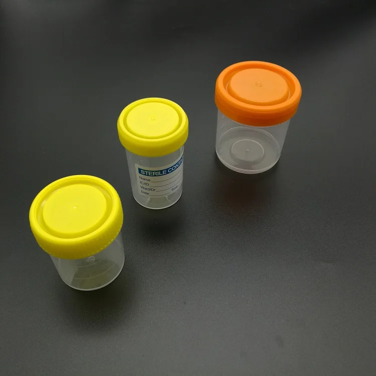 urine cup (4).jpg