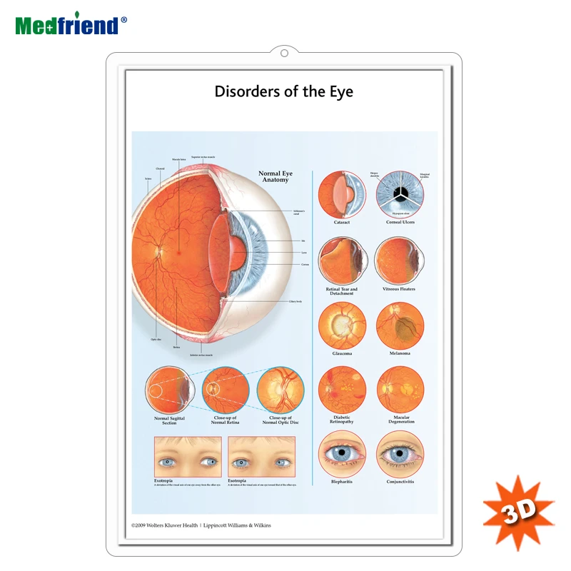 Eye Medical Chart