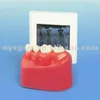 Laser Dry Medical Pet X-ray Film Digital Radiography For Agfa Printer
