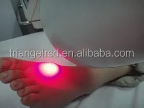 980nm diode laser for vascular, spider veins, nail fungus treatment device