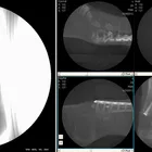 Medical X Ray 3D Medical Fluoroscopy Machine Medical C Arm X Ray Machine PLX7200