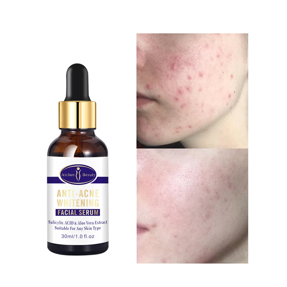 Aichun Beauty Anti-Acne Whitening Facial Serum Dispels Acne Natural Organic Facial Oil Serum, Transparent
Aichun Beauty Anti-Acne Whitening Facial Serum Dispels Acne Natural Organic Facial Oil Serum, Transparent