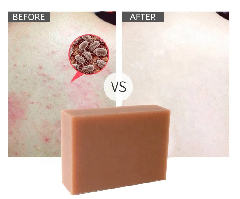 OEM Private label Natural Organic Skin Care Handmade Toilet Bath Soap Bar Oil Control Whitening Anti Acne Turmeric Soap
OEM Private label Natural Organic Skin Care Handmade Toilet Bath Soap Bar Oil Control Whitening Anti Acne Turmeric Soap