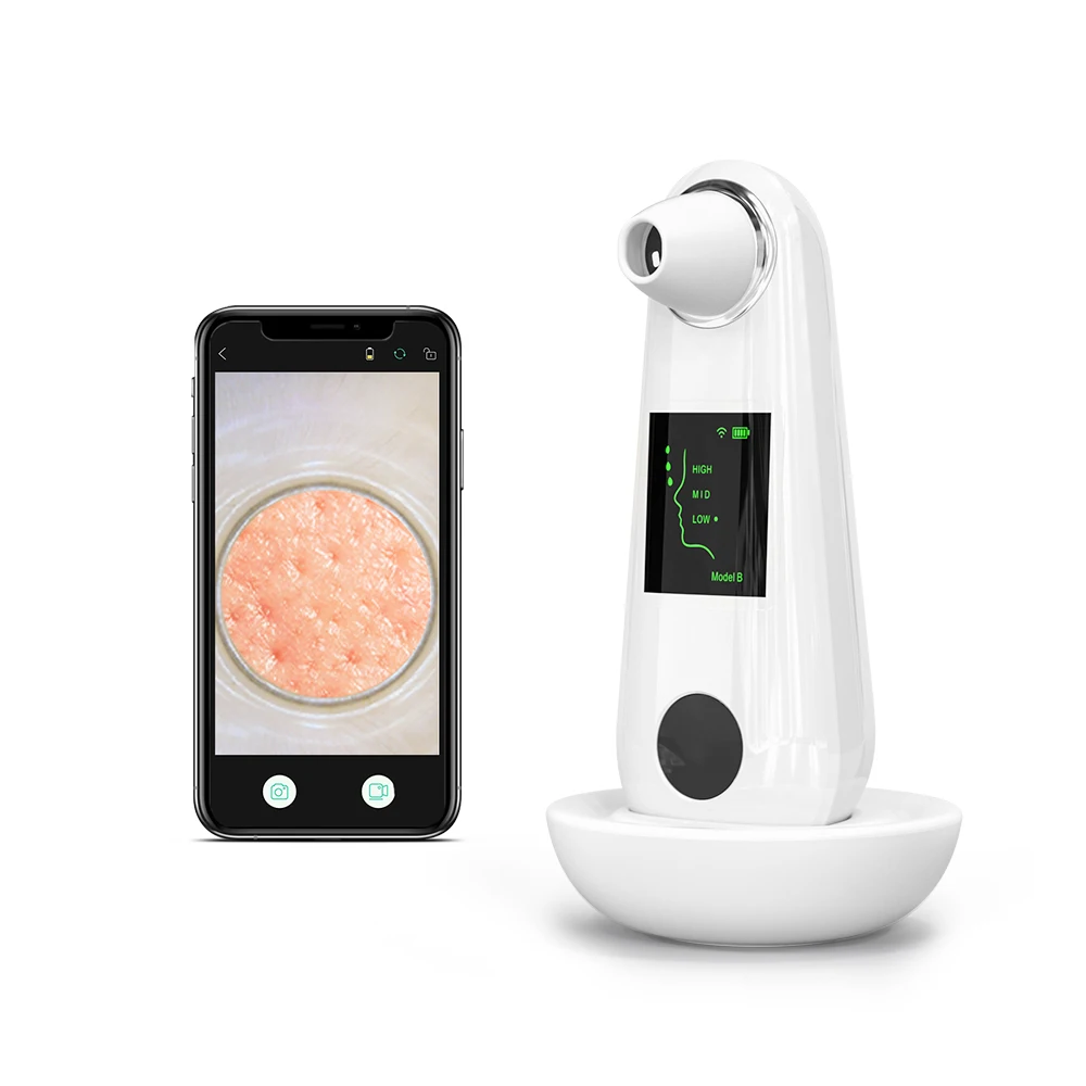 Rechargeable Beauty Personal Care Facial Remover Nose Blackhead Suction Device Deep Cleaning Vacuum Blackhead Cleanser, White (accept oem colors)
Rechargeable Beauty Personal Care Facial Remover Nose Blackhead Suction Device Deep Cleaning Vacuum Blackhead Cleanser, White (accept oem colors)