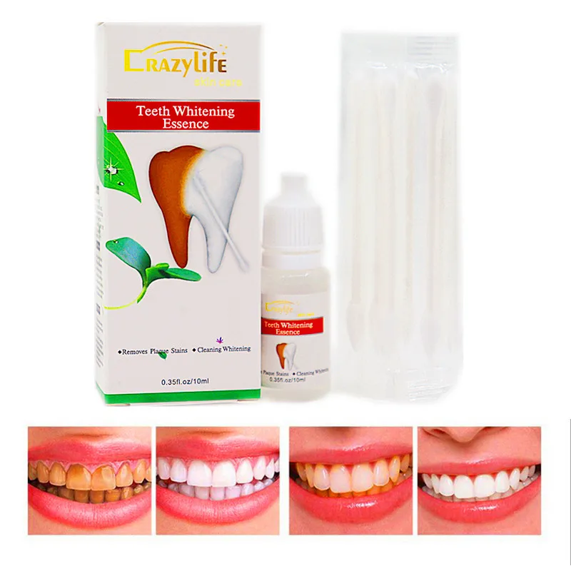 teeth whitening (1).jpg