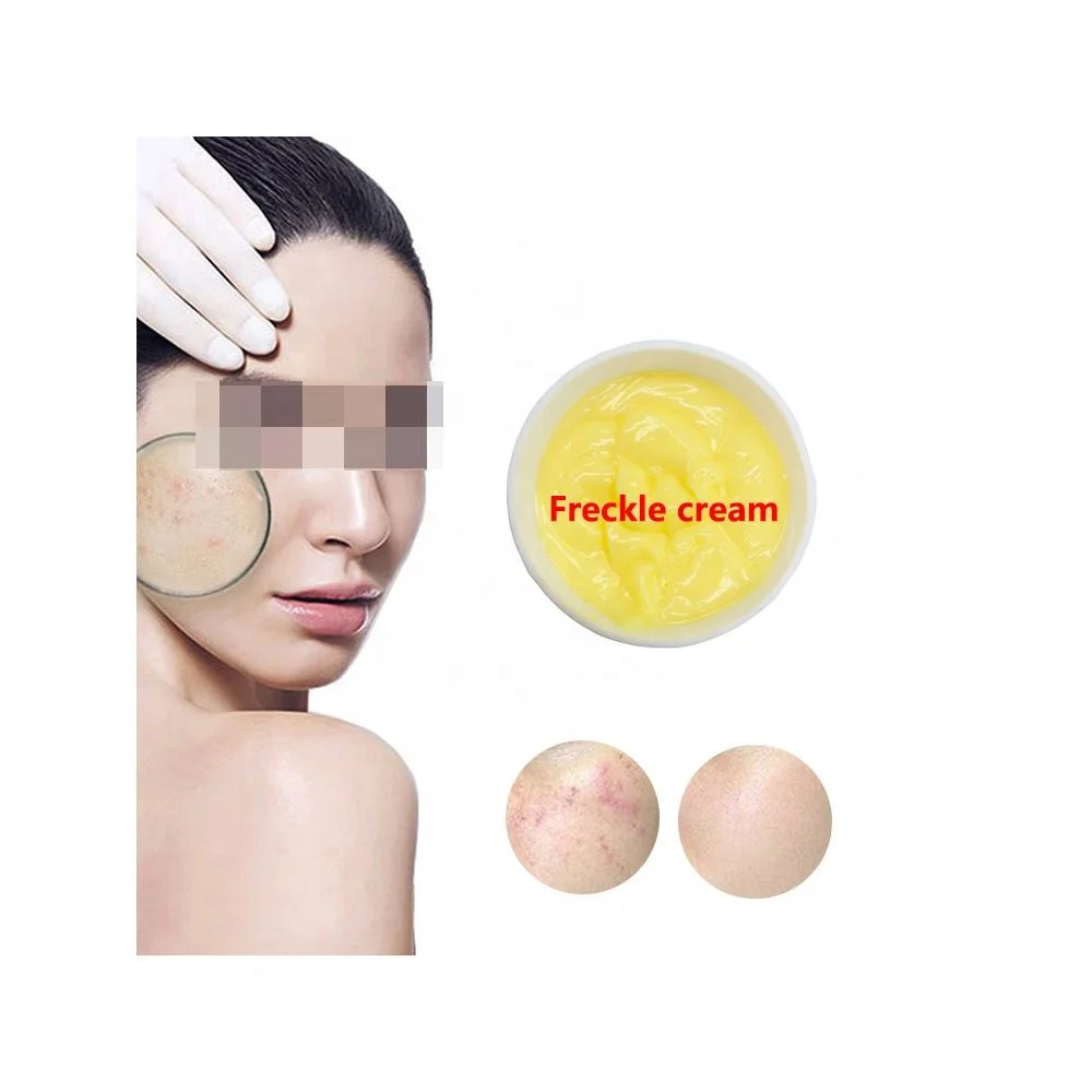 Pimples Dark Spot Corrector Remover Cream Face Black Spot And Pigment Removal Cream Dark Spot Corrector
Pimples Dark Spot Corrector Remover Cream Face Black Spot And Pigment Removal Cream Dark Spot Corrector