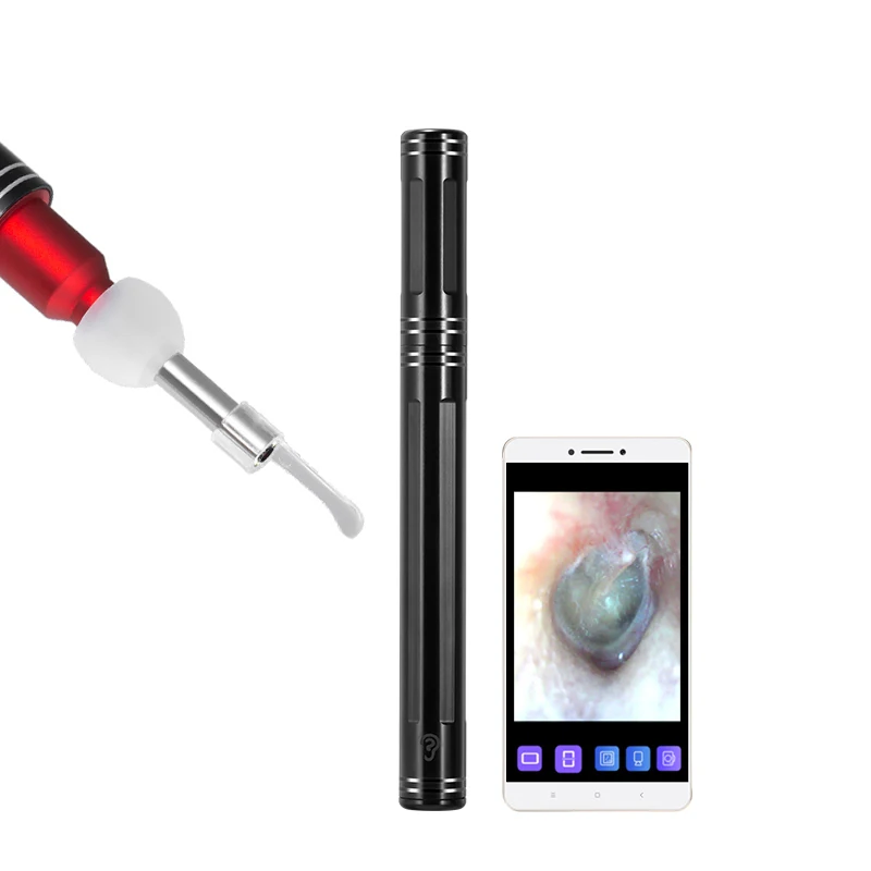 Newest HD Visual Ear Wax Remover Kit with Blue Light Sterilization, Black 
Newest HD Visual Ear Wax Remover Kit with Blue Light Sterilization, Black
