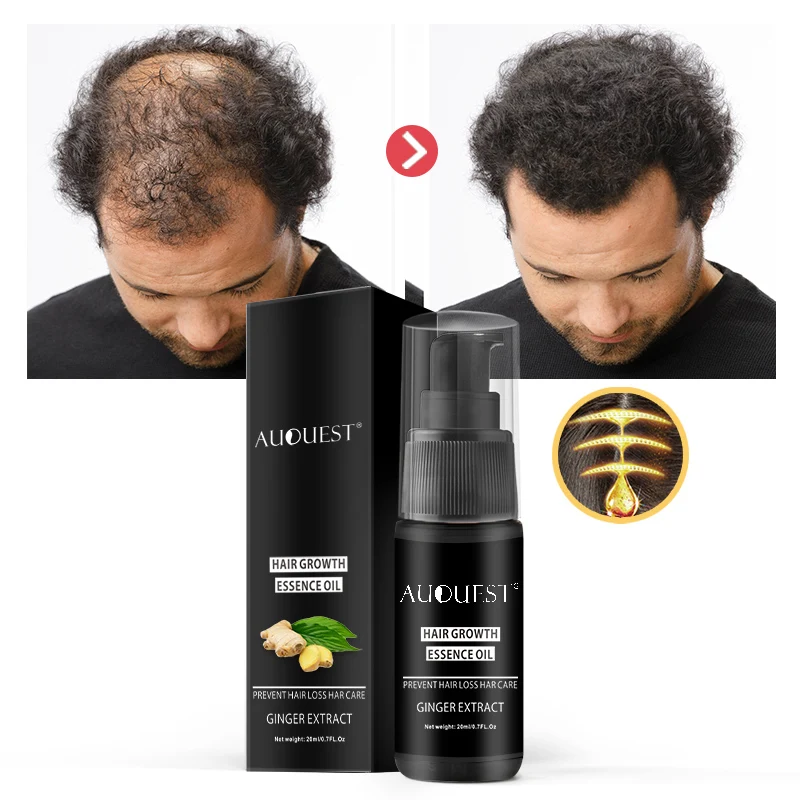 Private Label Organic Oil for Hair Growth Men Fast Effect Ginger All Natural CBD Custom Hair Growth Oil
Private Label Organic Oil for Hair Growth Men Fast Effect Ginger All Natural CBD Custom Hair Growth Oil