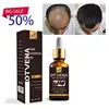 Best selling items men hair loss baldness treatment hair oil for hair growth