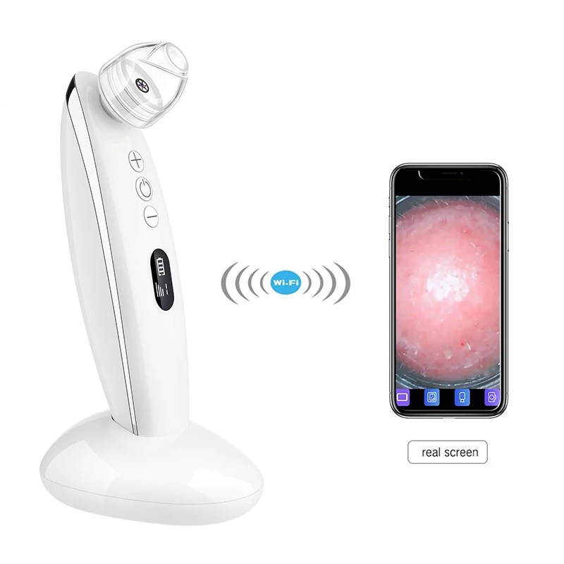 NEW ARRIVAL Visualization pore vacuum Professional electronic suction blackhead remover machine visual blackhead remover, White,green
NEW ARRIVAL Visualization pore vacuum Professional electronic suction blackhead remover machine visual blackhead remover, White,green