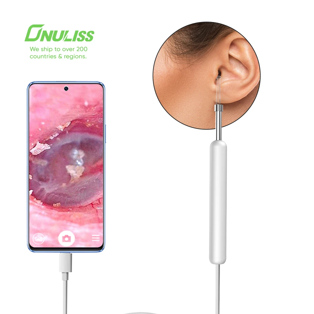 Ear Cleaner Visible Ear Scoop Camera Wax Removal Kit Ear Wax Removal Tool with Otoscope
Ear Cleaner Visible Ear Scoop Camera Wax Removal Kit Ear Wax Removal Tool with Otoscope