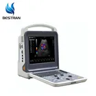 BT-UD12 hospital digital Laptop Ultrasound scanner for pregnancy 4d color doppler ultrasound machine portable
