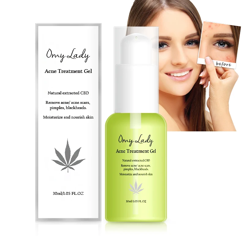 omy lady herbal Acne Scar lightening damaged skin repairing acne scar repairing cream
omy lady herbal Acne Scar lightening damaged skin repairing acne scar repairing cream
