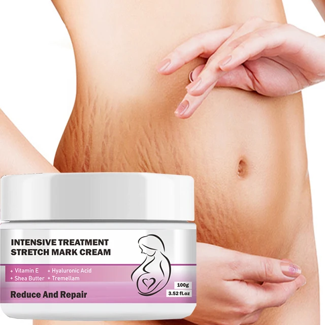 AH Natural Best Pregnancy Anti Stretch Mark Removal Cream for Belly Stomach Butt Tight
AH Natural Best Pregnancy Anti Stretch Mark Removal Cream for Belly Stomach Butt Tight
