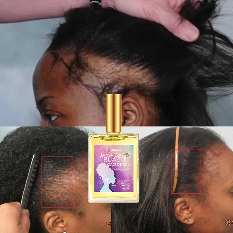 Boost Lashes And Brows Growth Organic Castor Growth Hair Oil Treatment For Dandruff Hair
Boost Lashes And Brows Growth Organic Castor Growth Hair Oil Treatment For Dandruff Hair
