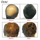 Hair Loss Solutions Thinning Concealer Fibers Keratin Restore Instant Hair Thickener 10Colors