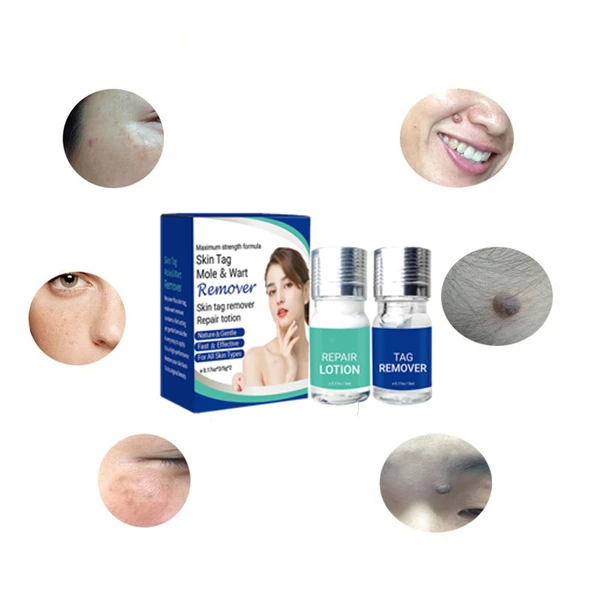 Natural Body Warts Treatment Skin Tag Mole Removal Pen Foot Corn Removal Plantar Liquid Warts Flat Skin Care Repair Pen
Natural Body Warts Treatment Skin Tag Mole Removal Pen Foot Corn Removal Plantar Liquid Warts Flat Skin Care Repair Pen